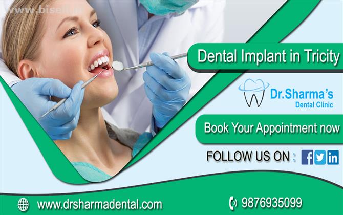 Best Dental Implant in Mohali