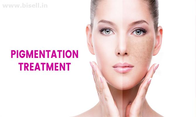 Best Doctor for Pigmentation Treatment in Gurgaon