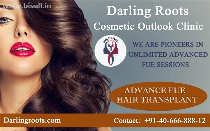 Best FUE Hair Transplant Clinic in Hyderabad | Darling Roots