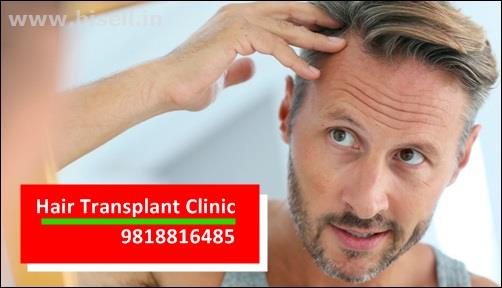 Best Hair Transplant Clinic in Gurgaon