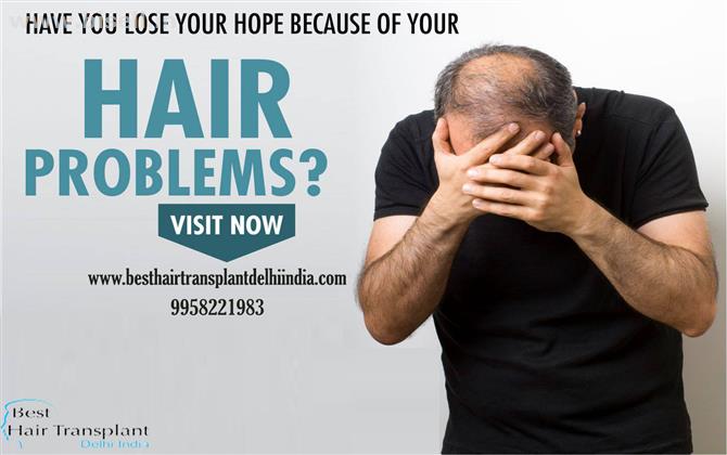 Best Hair Transplant Surgery Price in South Delhi Call @ 9958221983