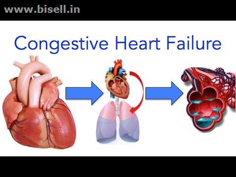 Best Hospitals for Congestive Cardiac Failure in Delhi - Healthyzer