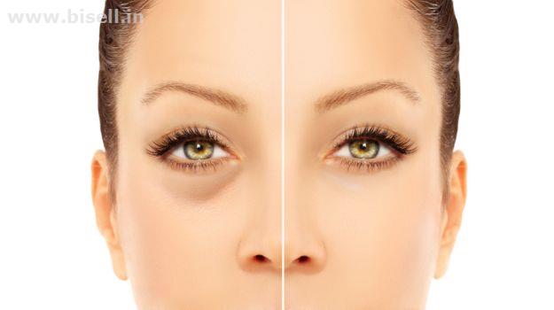 Dark Circles doctor in Delhi