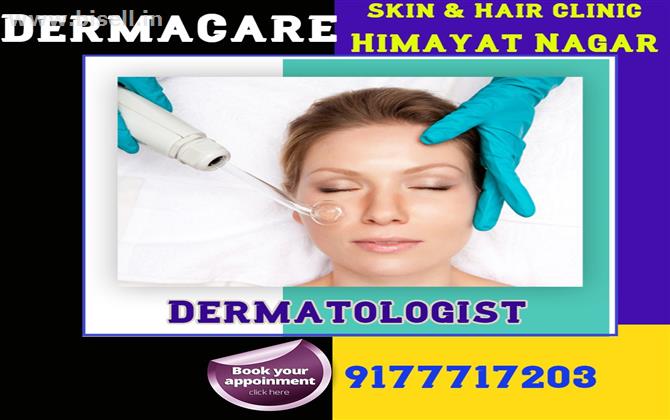 Dermatologist in Hyderabad | Skin Specialist in Himayat Nagar