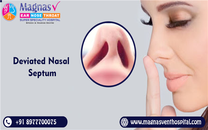 Deviated Nasal Septum Treatment in Hyderabad