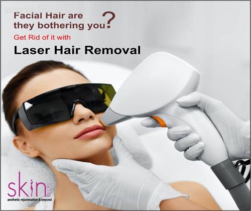 Get Rid of Facial Hair with Laser hair removal