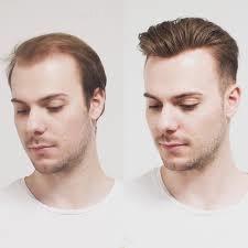 Hair transplant clinic in Mumbai