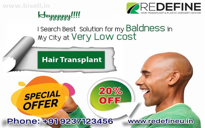 Hair Transplant in Hyderabad | Hair Transplant Cost Hyderabad