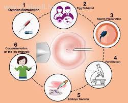 ICSI treatment in jaipur