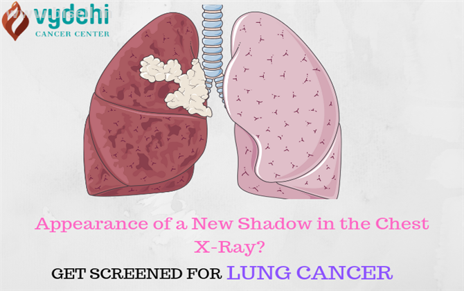 Lung Cancer Treatment at Vydehi Cancer Center