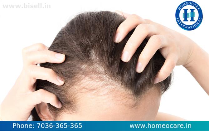 Natural Solution for Hair Regrowth