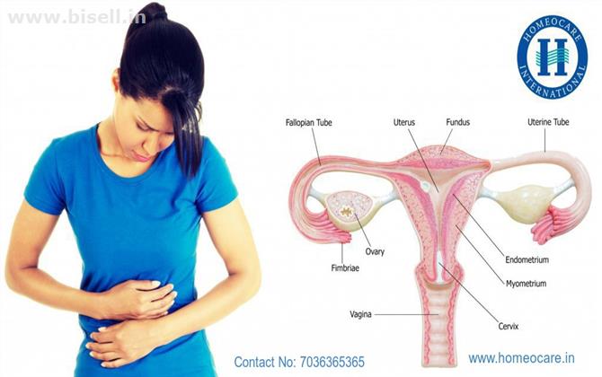 PCOS Treatment in Vijayawda