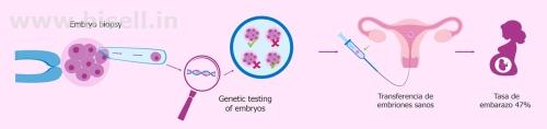 PGD,Preimplantation Genetic Diagnosis Treatment at SWCIC