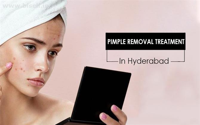 Pimple removal treatment.