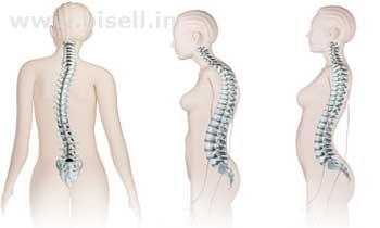 Spinal Infections Treatment