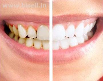 TEETH CLEANING & WHITENING TREATMENT SERVICES