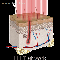 USFDA Aproved Regrowth Rejuvenation System-Best One